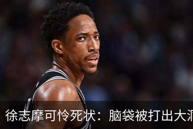 徐志摩可怜死状：脑袋被打出大洞，四肢被烈火炙烤成焦炭！